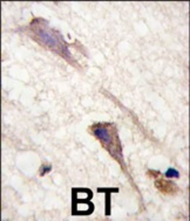 ANTI-B-RAF, 0,1 MG