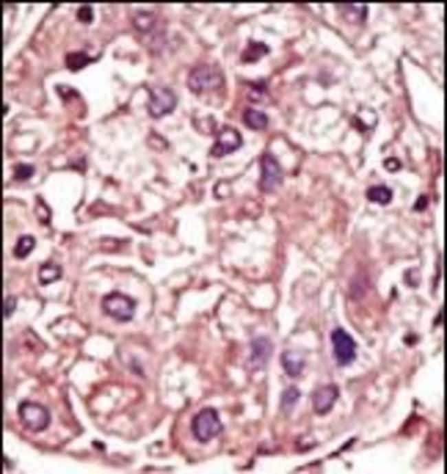 Anti-TGF beta Receptor I 0.1 mg MG