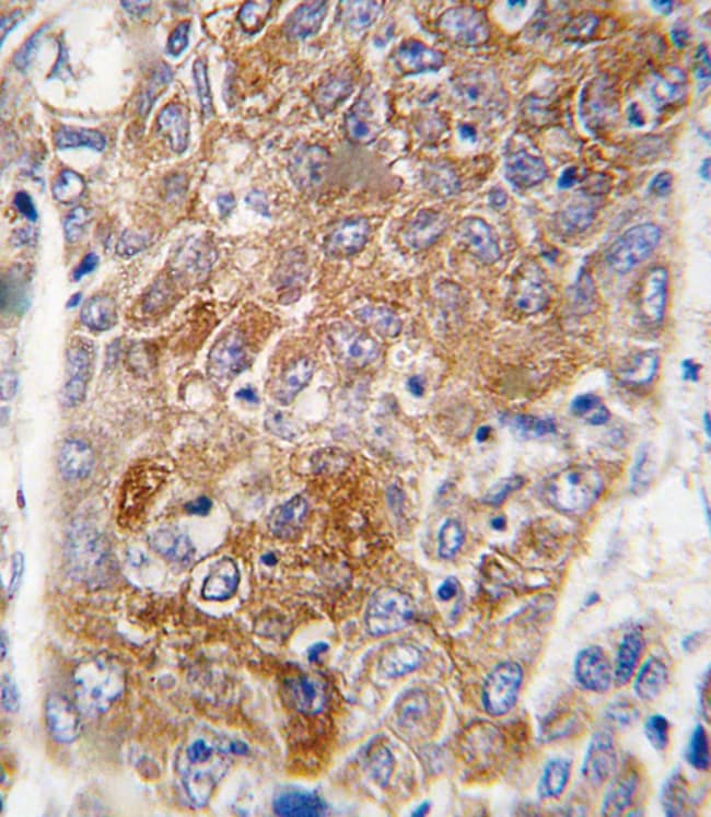 ANTI-ALDH1L1, 0,1 MG