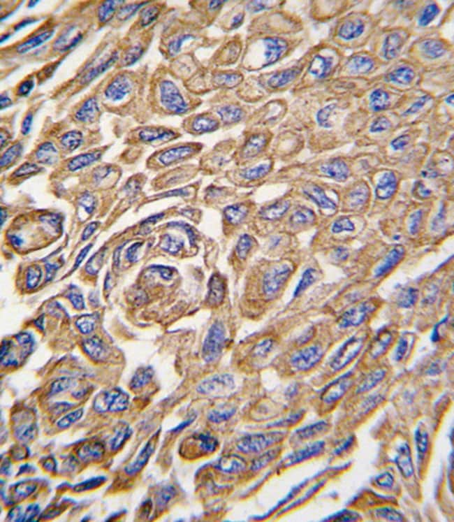 ANTI-ALDH3A1, 0,1mg .