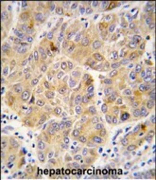 ANTI-ALDH9A1, 0,1mg .