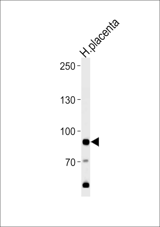 ANTI-AMPD3, 0,1 MG