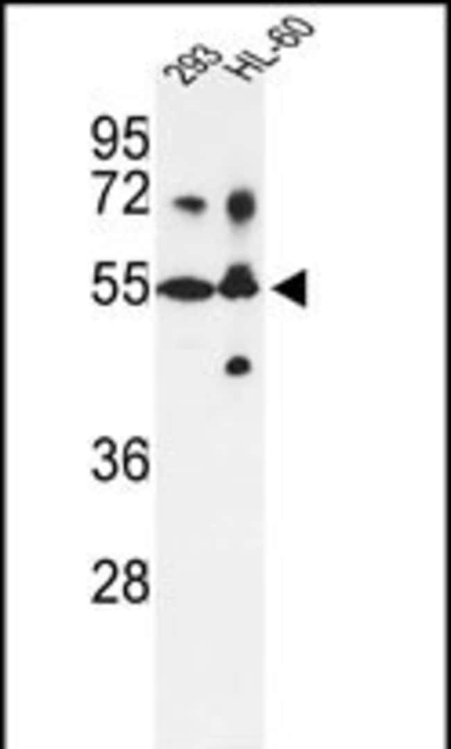 ANTI-CYP21A2, 0,1 MG