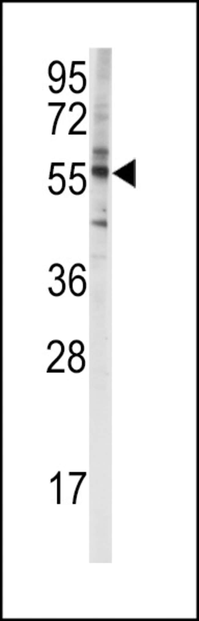ANTI-CYP4F8, 0,1 MG