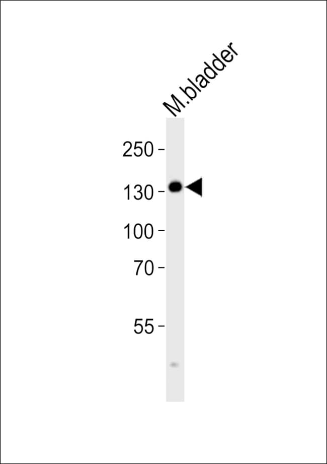 100UG ANTI-MLCK POLYCLONAL ANTIBODY .