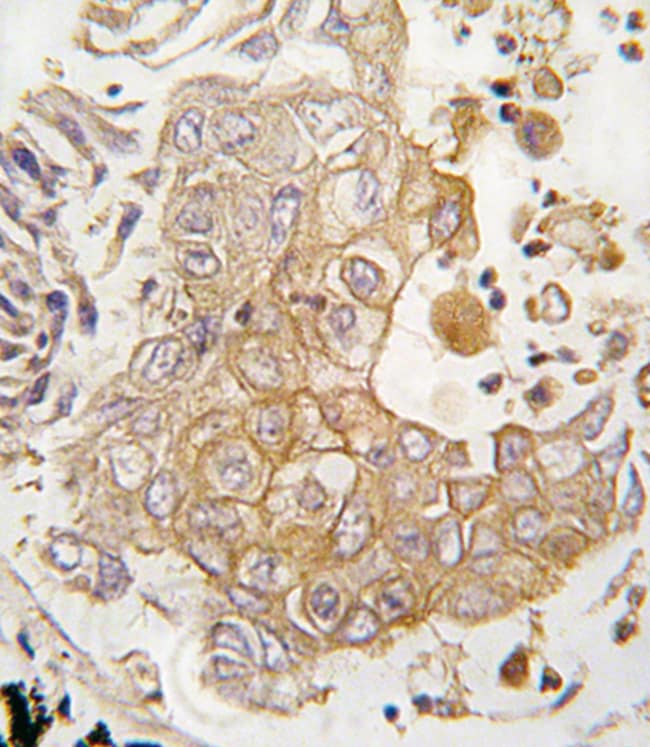 ANTI-CYP1A1, 0,1mg .