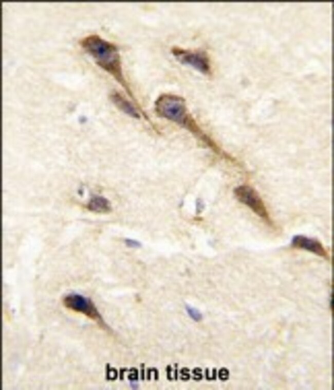 ANTI-CYP26B1, 0,1 MG