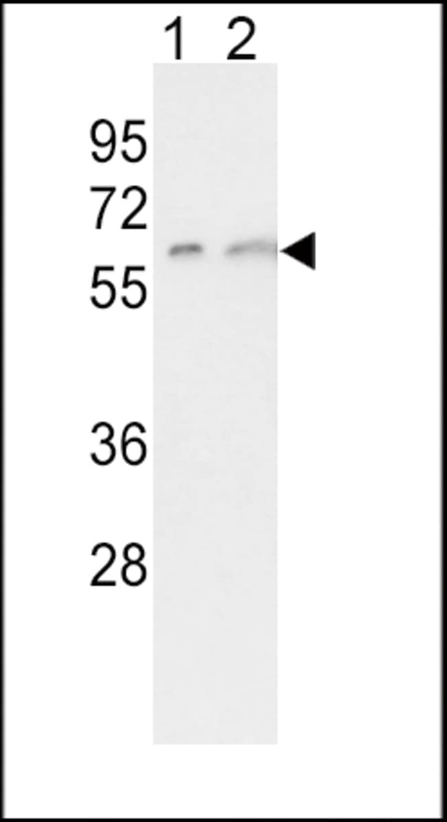 ANTI-CYP7A1, 0,1mg .