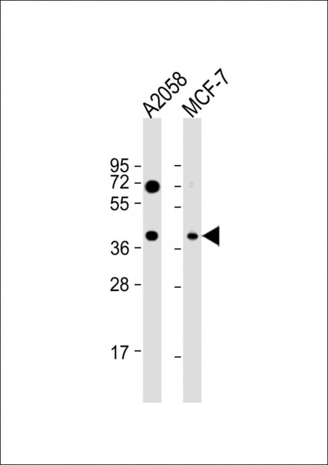 100µG ANTI-GNA12 .