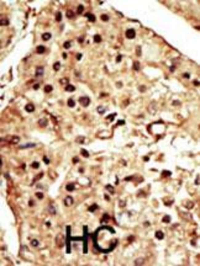 ANTI-TRPM7, 0,1 MG