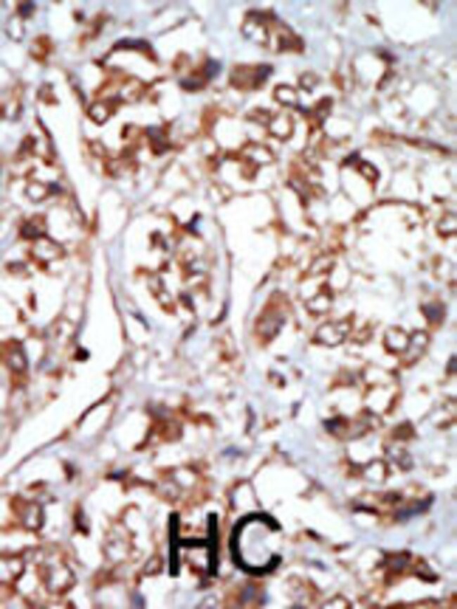 ANTI-HRI, 0,1 MG