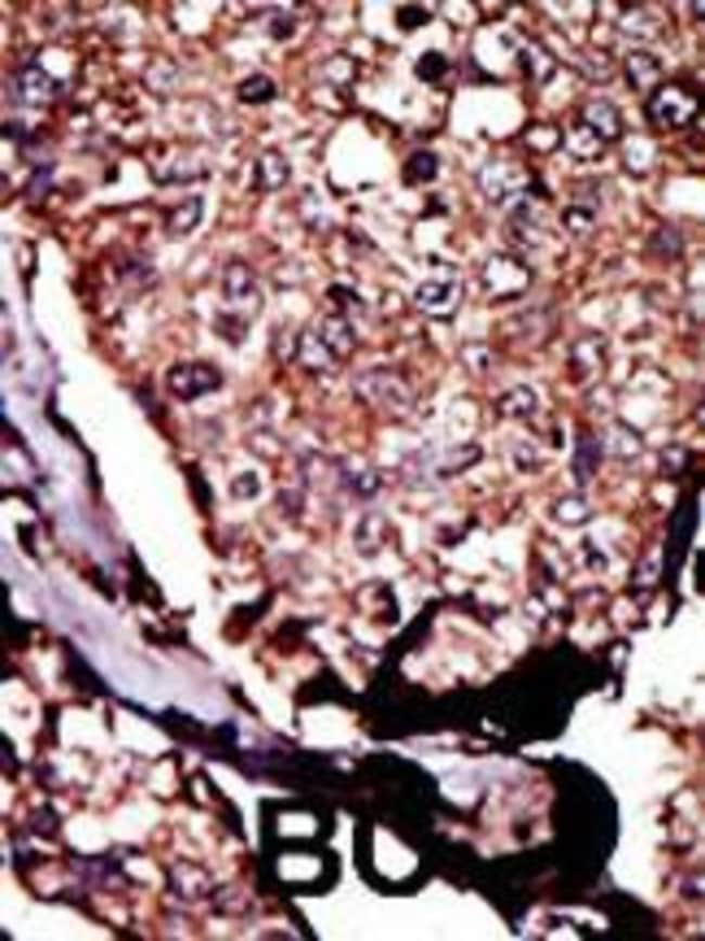 ANTI-DGKB, 0,1mg .