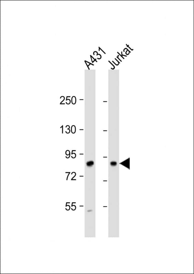 ANTI-DGKA, 0,1mg .