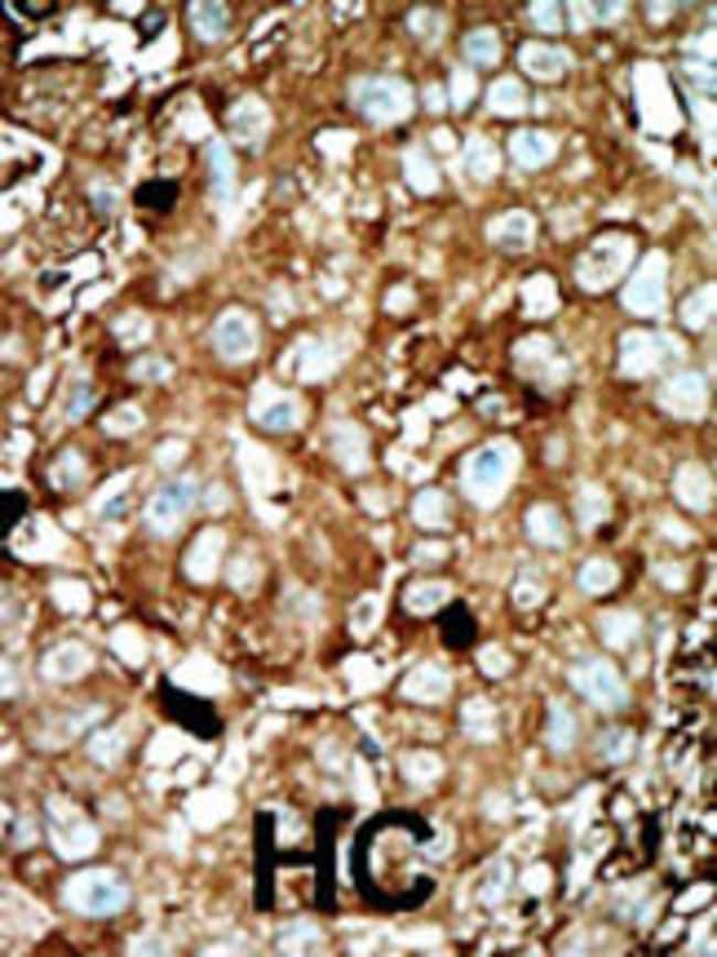 ANTI-PFKFB3, 0,1mg .