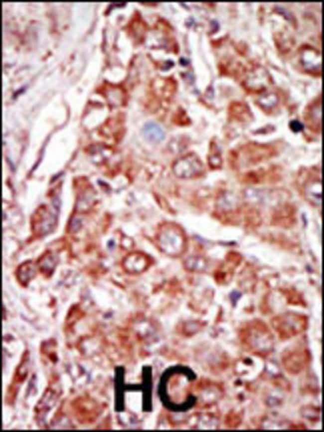 ANTI-PKR, 0.1mg .