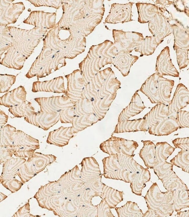 ANTI-PFKFB4, 0,1 MG