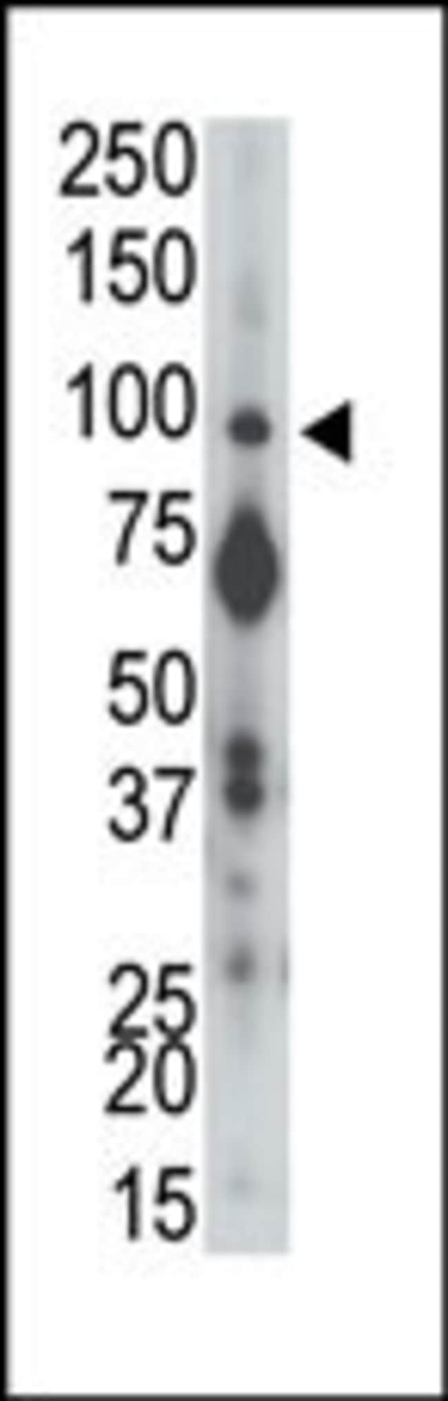 ANTI-PTP ALPHA, 0,1mg .