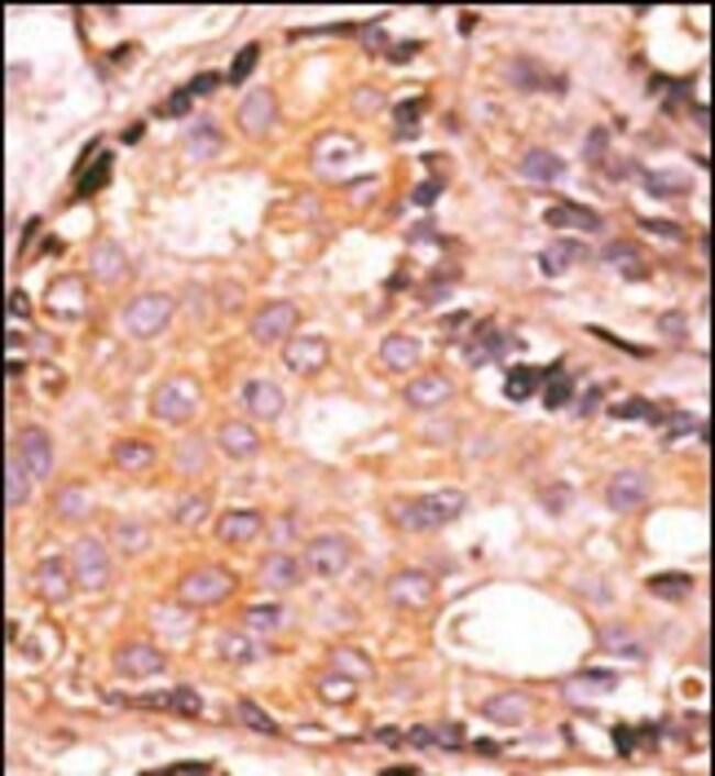 ANTI-DUSP4, 0,1 MG
