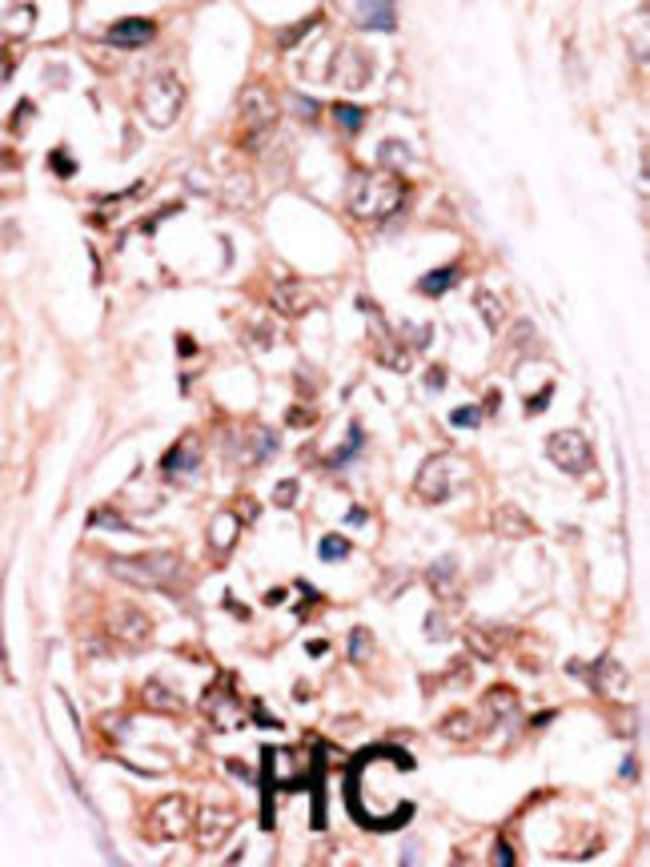 ANTI-DUSP14, 0,1 MG