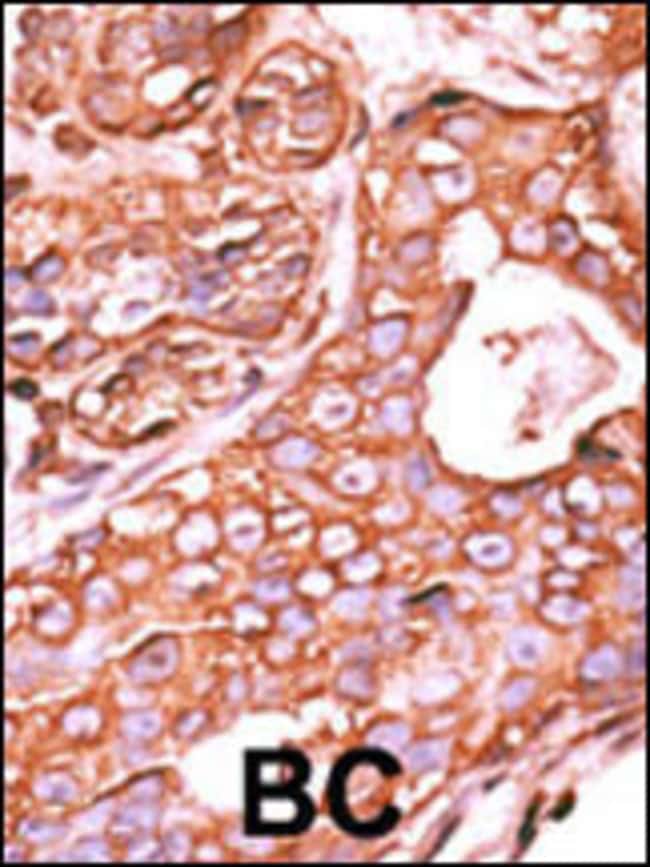 ANTI-PPM1F, 0,1 MG