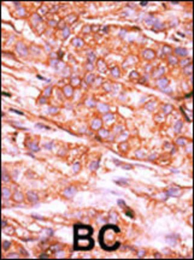 ANTI-CTDSP2, 0,1mg .