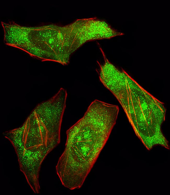 100 UG POLYCLONAL ANTIBODY, PROTEIN, HOS