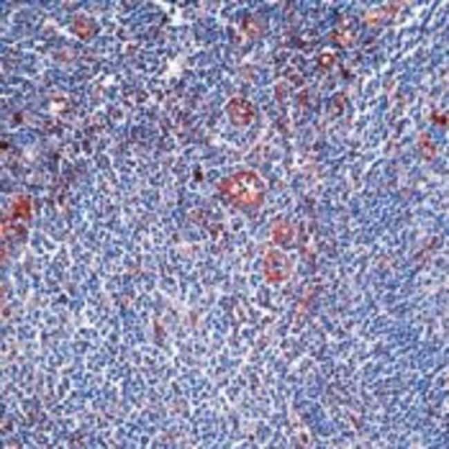 Alpha-1-itrypsin  Rabbit Polyclonal Anti