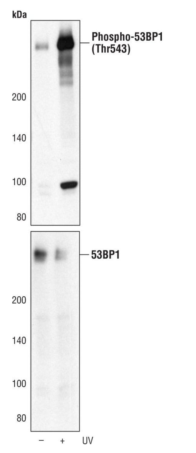 100UL PHOSPHO-53BP1 (THR543) in 10mM sod