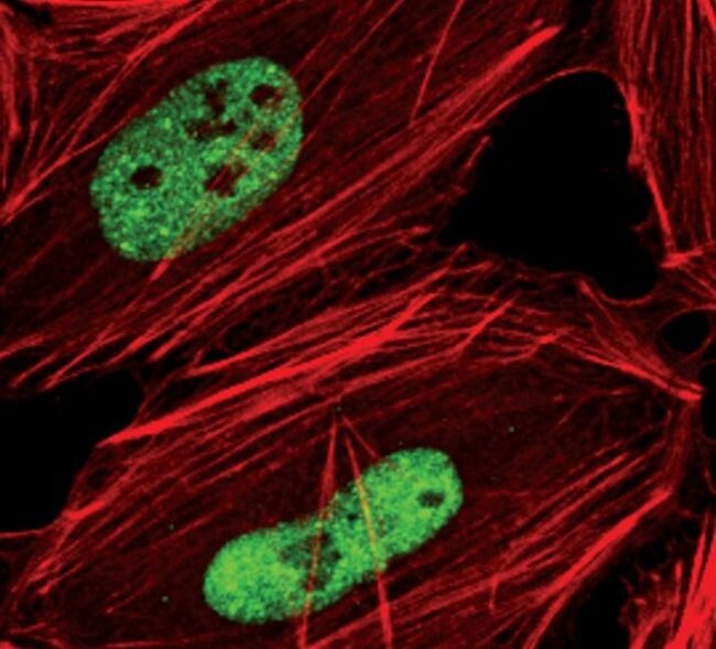ANTIBODY ANTI-TDP43, 100µL