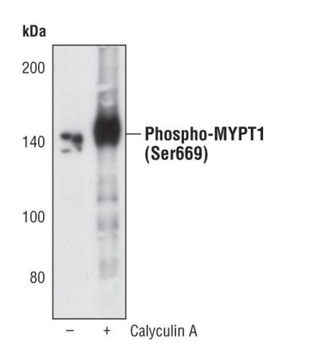 100UL PHOSPHO-MYPT1 (SER668) .