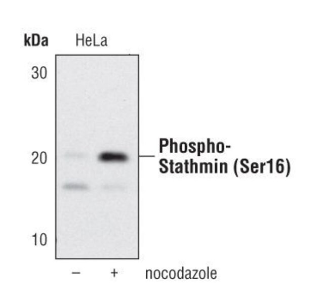 100UL PHOSPHO-STATHMIN (SER16) .