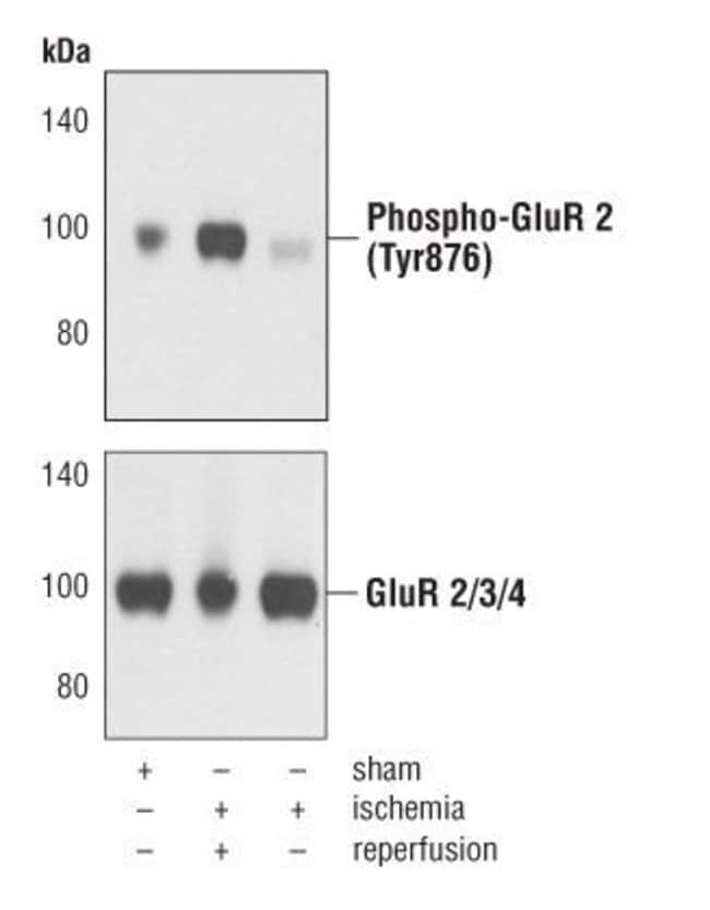 Antibody Phospho-AMPA Receptor (GluR 2)