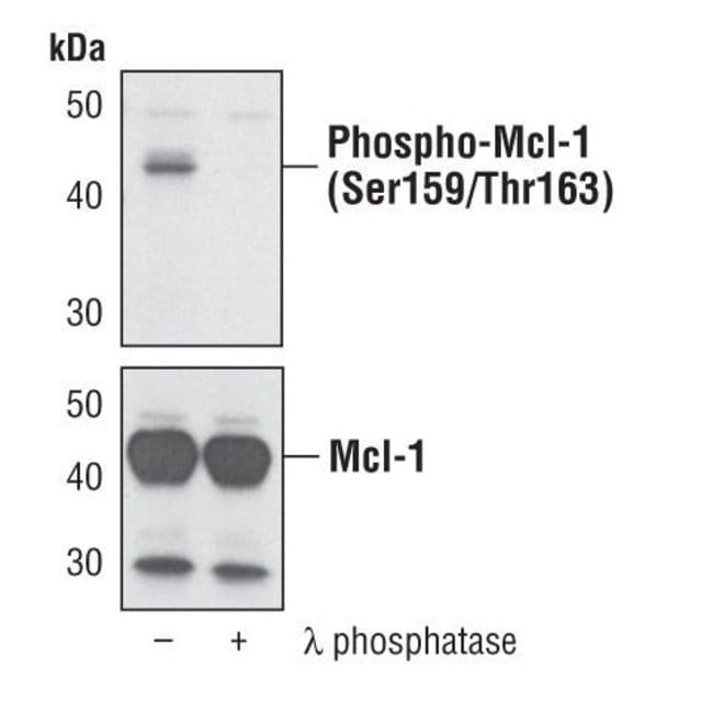 100UL PHOSPHO-MCL-1 (SER159/THR163) .