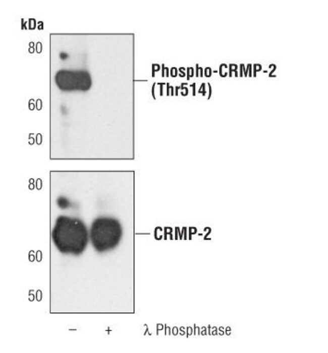 100UL PHOSPHO-CRMP-2 (THR514) .