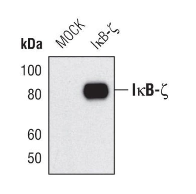 100UL I-KAPPA-B-ZETA in 10mM sodium HEPE