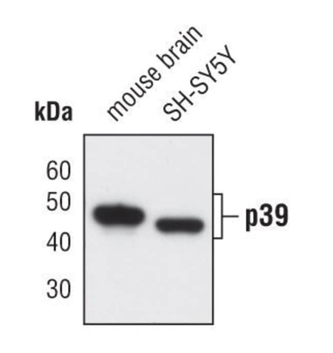 100UL P39 45kDa, in 10mM sodium HEPES, p