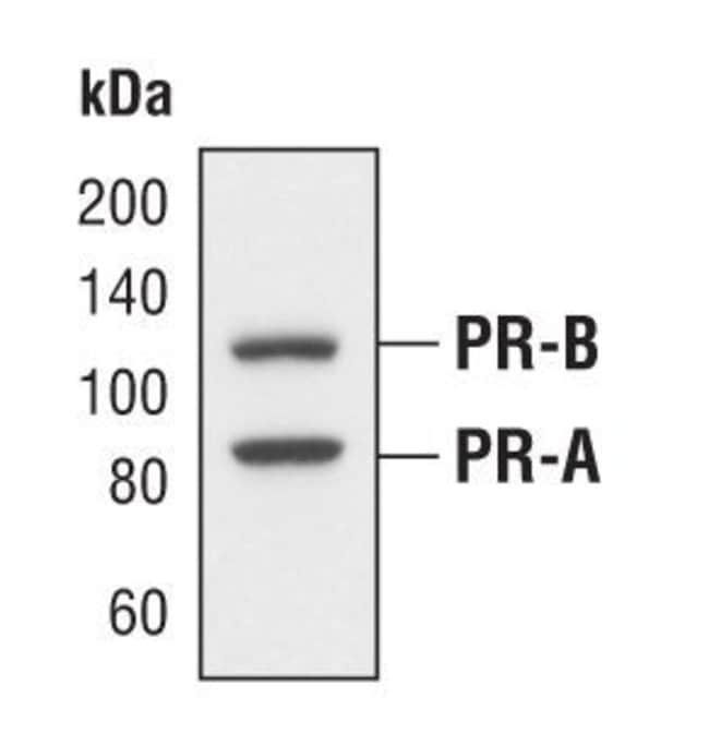 100UL PROGESTERONE RECEPTOR A/B kDa, in