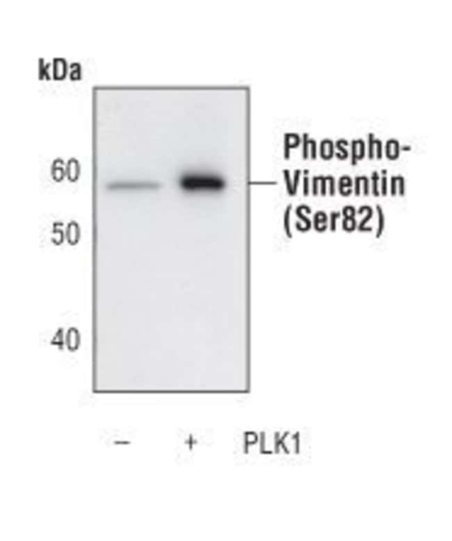 100UL PHOSPHO-VIMENTIN (SER82) .