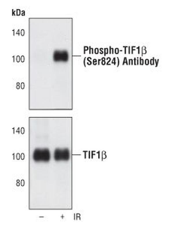 100UL PHOSPHO-TIF1BETA (SER824) .