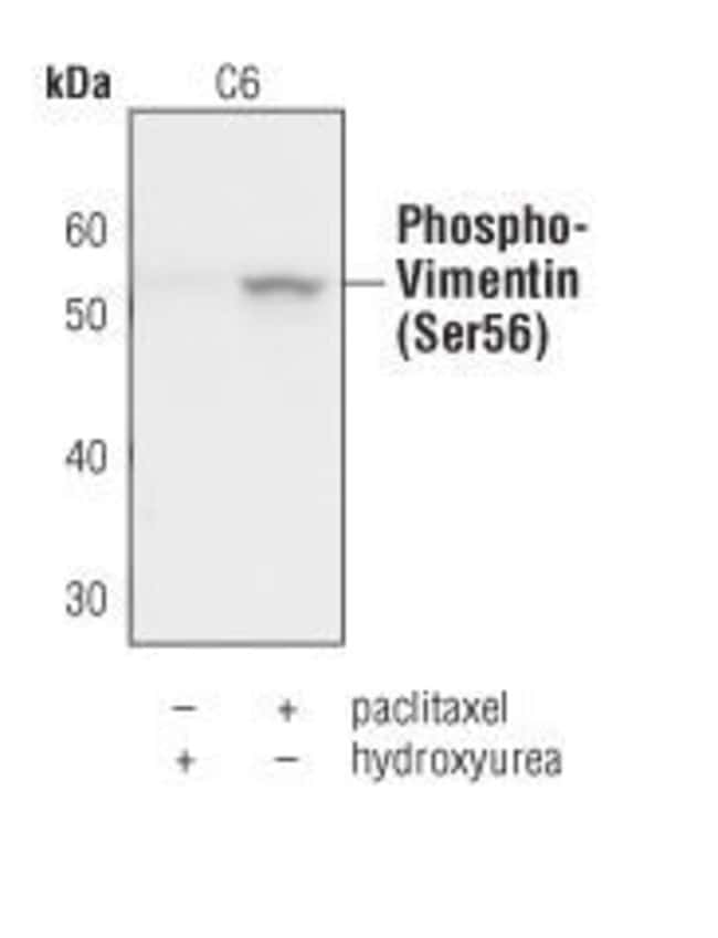 100UL PHOSPHO-VIMENTIN (SER56) .