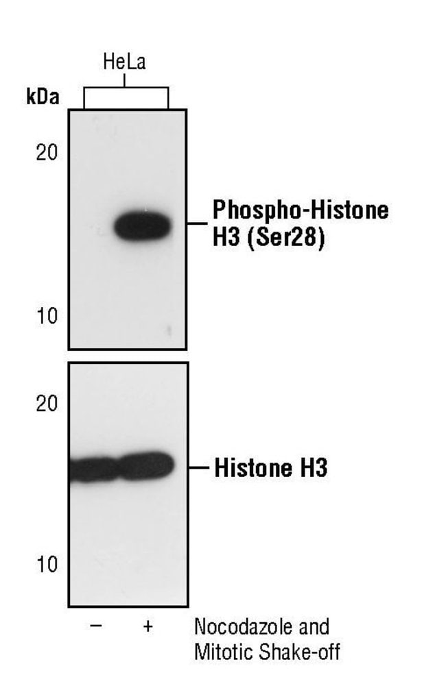 100UL PHOSPHO-HISTONE H3 (SER28) .