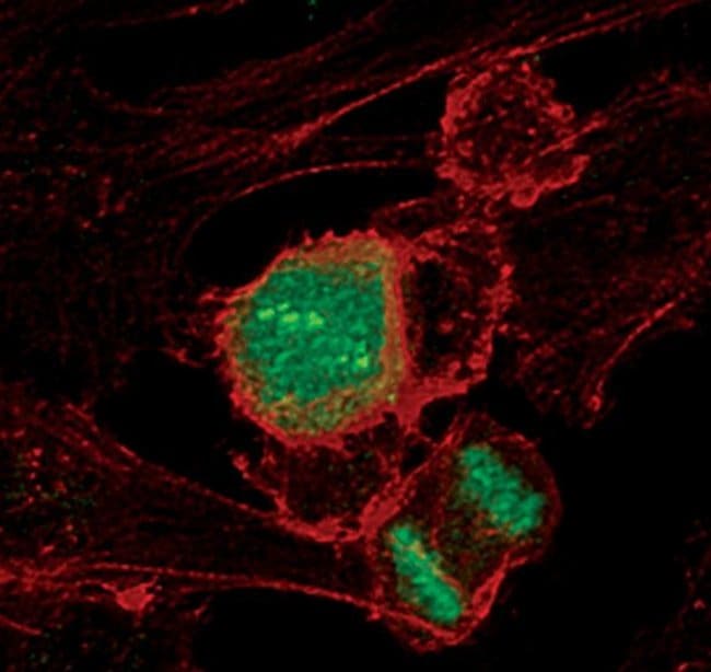 100UL PHOSPHO-HISTONE H3 (THR11) .