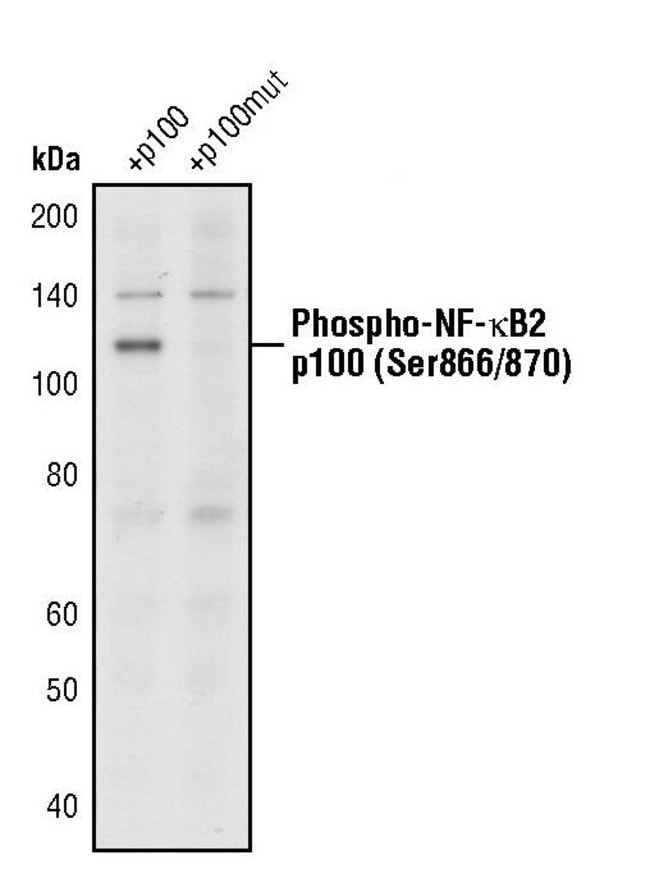 Antibody Phospho-NF-kappa B2 p100 (Ser86