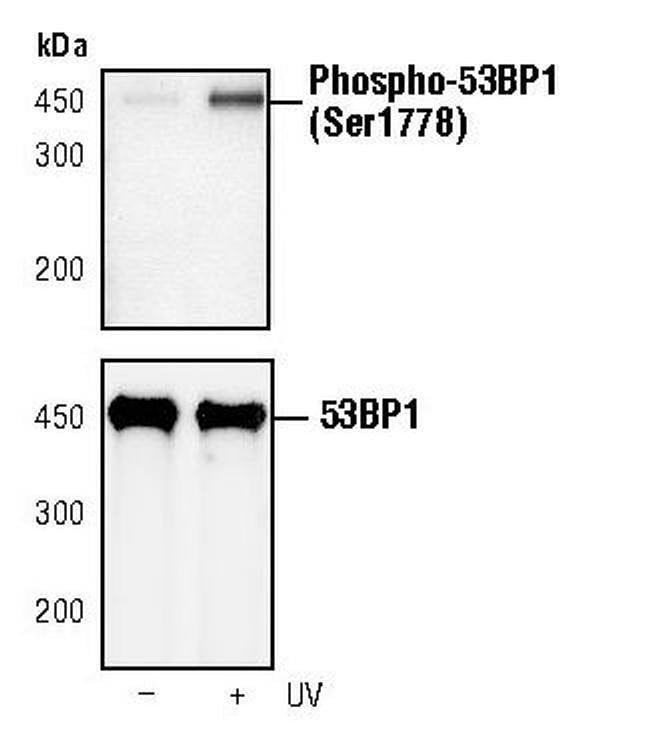 100UL PHOSPHO-53BP1 (SER1778) .