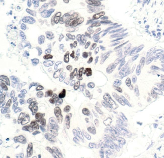 100UL PHOSPHO-HISTONE H3 (THR3) .