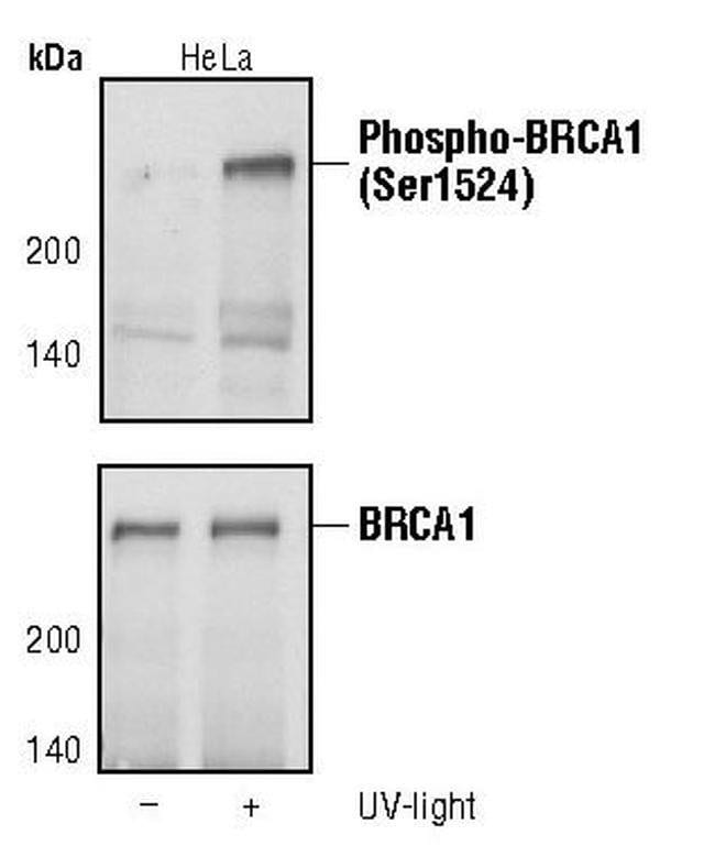 100UL PHOSPHO-BRCA1 (SER1524) .