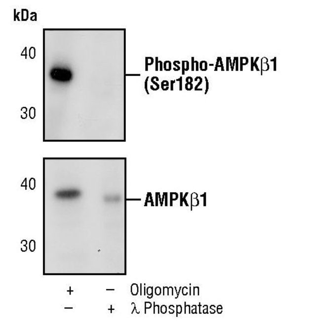 100UL PHOSPHO-AMPKBETA1 (SER182) .