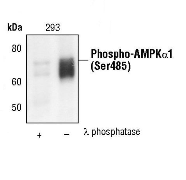 100UL PHOSPHO-AMPK-ALPHA1 (SER485) .