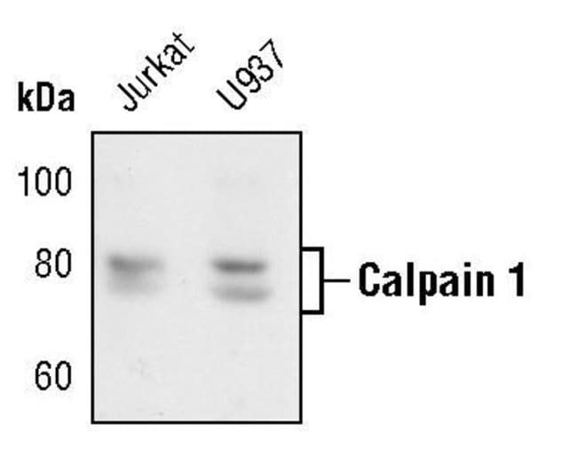 100UL CALPAIN 1 LARGE SUBUNIT (MU-TYPE)