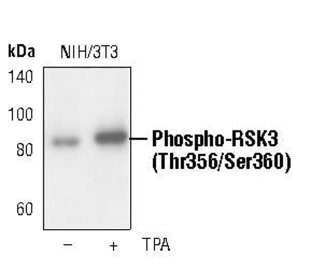 100UL PHOSPHO-RSK3 (THR356/SER360) .